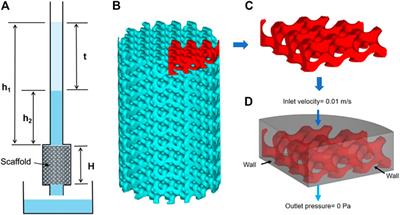 Pore Strategy Design of a Novel NiTi-Nb Biomedical Porous Scaffold Based on a Triply Periodic Minimal Surface